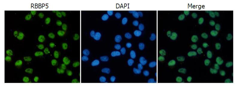 小鼠抗RBBP5单克隆抗体