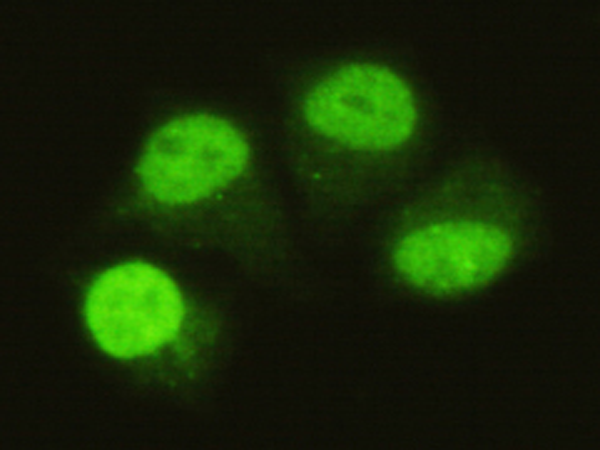 小鼠抗SMAD5(C-term)单克隆抗体