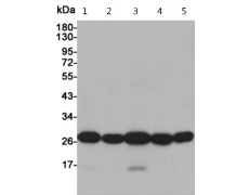 小鼠抗SOD2单克隆抗体