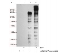 小鼠抗Phospho-Tyrosine单克隆抗体