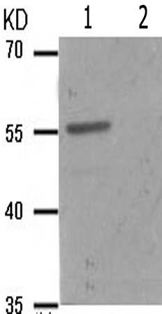 兔抗CHEK1(Phospho-Ser286) 多克隆抗体