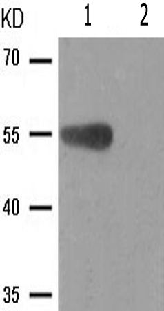 兔抗CHEK1(Phospho-Ser301) 多克隆抗体