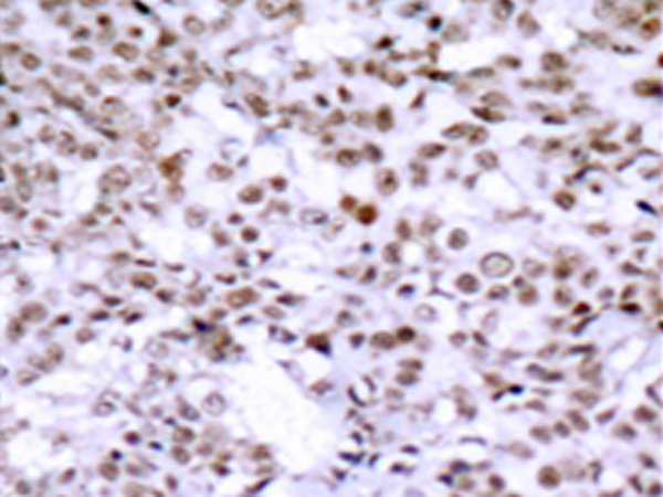兔抗CHEK2(Ab-68) 多克隆抗体