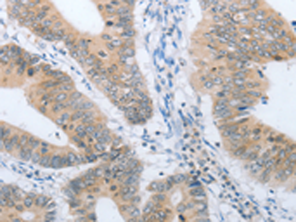 兔抗CHRNA10多克隆抗体