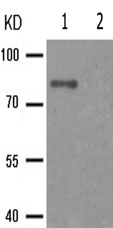 兔抗CHUK(Phospho-Ser176/177) 多克隆抗体 