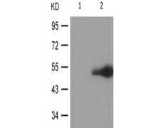 兔抗GFAP(Phospho-Ser38) 多克隆抗体