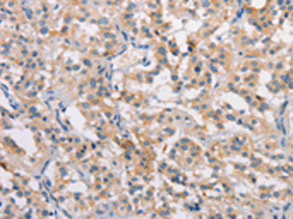 兔抗CLDN11多克隆抗体