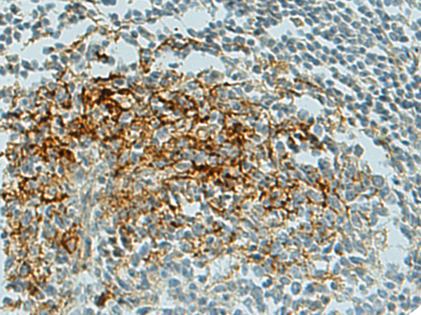 兔抗CLEC7A多克隆抗体