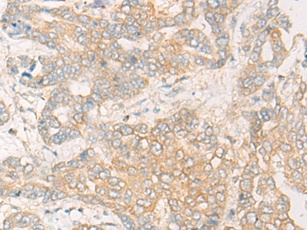 兔抗CLEC12A多克隆抗体