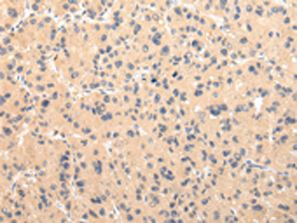 兔抗CMKLR1多克隆抗体