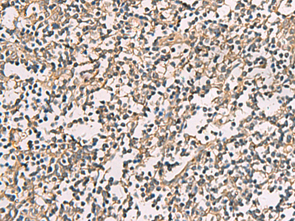 兔抗CMTM4多克隆抗体