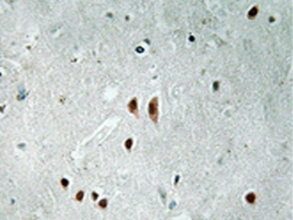 兔抗CNOT2(Phospho-Ser101)多克隆抗体