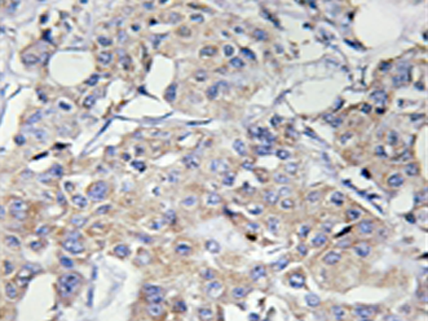 兔抗COL6A3多克隆抗体
