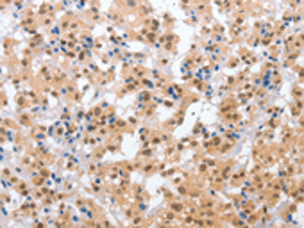 兔抗CPSF4多克隆抗体