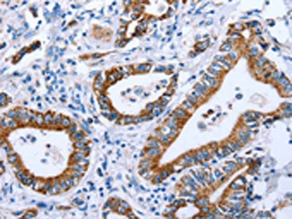 兔抗CPT1A多克隆抗体