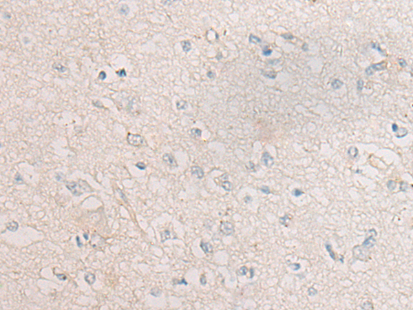兔抗CR1L多克隆抗体