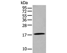 兔抗GKN2多克隆抗体