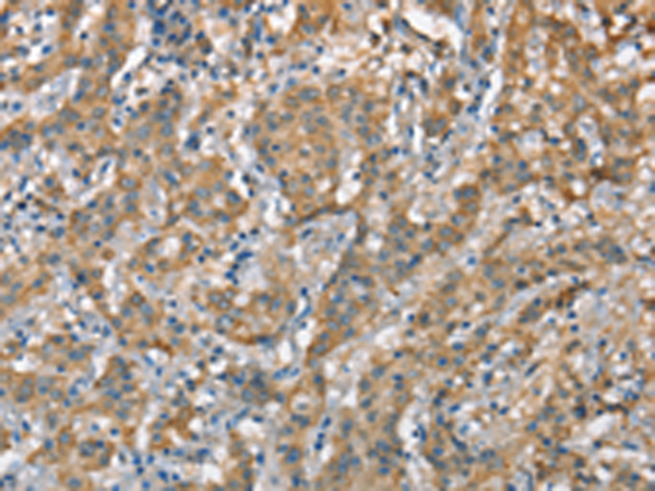 兔抗CSMD1多克隆抗体