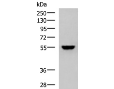 兔抗KPNA2多克隆抗体