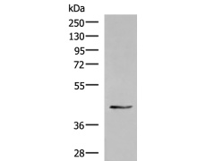 兔抗KRR1多克隆抗体