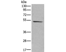 兔抗KRT7多克隆抗体
