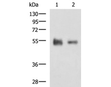 兔抗KRT12多克隆抗体