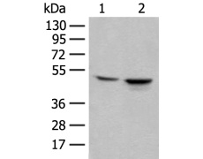 兔抗KRT17多克隆抗体