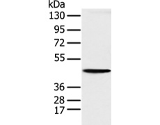 兔抗KRT18多克隆抗体