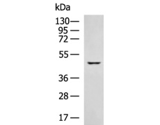 兔抗KRT23多克隆抗体