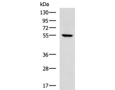 兔抗KRT81多克隆抗体