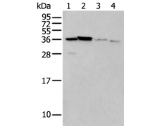 兔抗LASP1多克隆抗体