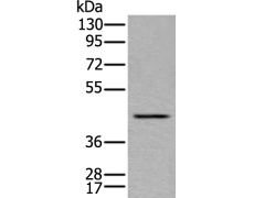 兔抗LMNTD1多克隆抗体