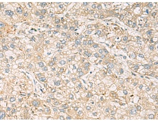 兔抗LRRC28多克隆抗体