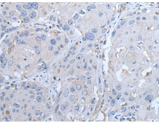 兔抗LTBP4多克隆抗体