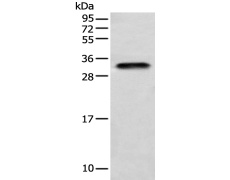 兔抗LYPD4多克隆抗体