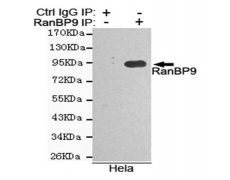 小鼠抗RANBP9单克隆抗体