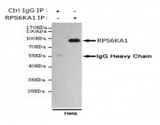 小鼠抗RPS6KA1单克隆抗体