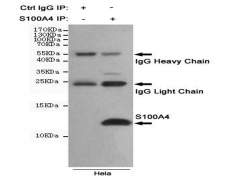 小鼠抗S100A4单克隆抗体