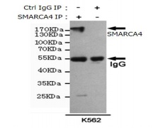 小鼠抗SMARCA4单克隆抗体