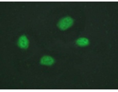 兔抗CHEK2(Phospho-Thr383) 多克隆抗体
