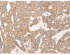 兔抗CHKB-CPT1B多克隆抗体