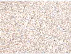 兔抗CHMP2B多克隆抗体