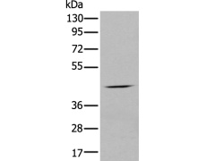 兔抗CHRNA5多克隆抗体