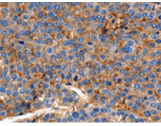 兔抗CLDN1多克隆抗体