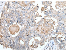 兔抗CLDN6多克隆抗体