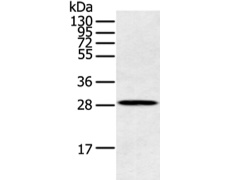 兔抗CLDN25多克隆抗体