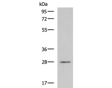 兔抗CLDND1多克隆抗体