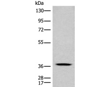 兔抗CLN5多克隆抗体