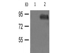 兔抗CTNNB1(phospho-Tyr333) 多克隆抗体