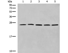 兔抗CYB5D1多克隆抗体